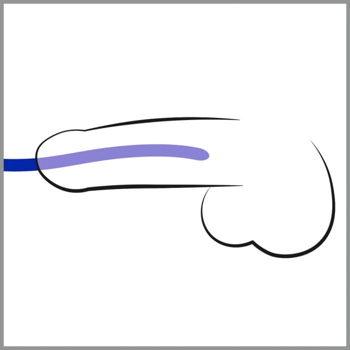 Набір силіконових уретральних вставок Silicone Dilator Set від Orion - Зображення 2